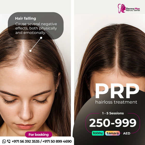 PRP Hairloss Treatment - Dermamax Medical Center