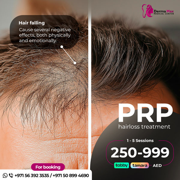 PRP Hairloss Treatment - Dermamax Medical Center