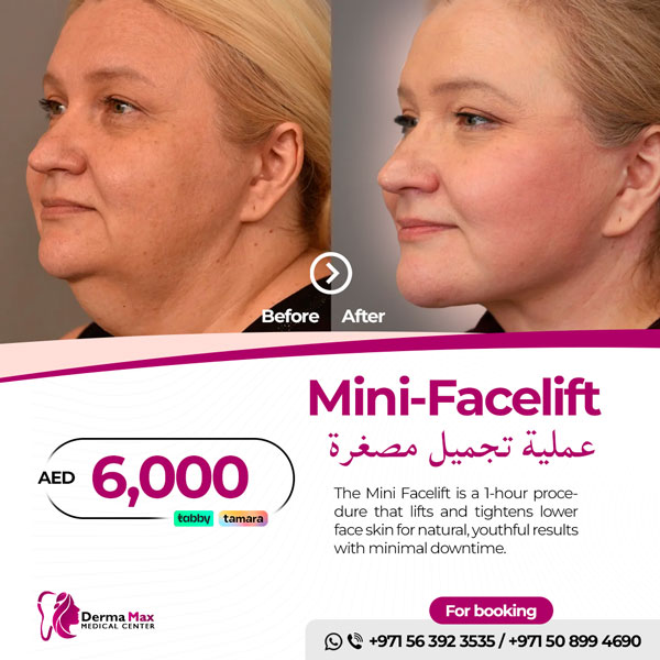 Mini Facelift - Dermamax Medical Center